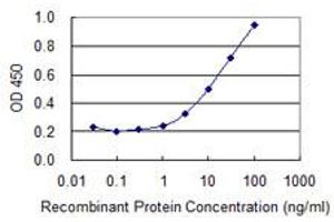 Detection limit for recombinant GST tagged ATP6V1B1 is 0.