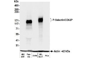 Western Blotting (WB) image for anti-Selectin P (Granule Membrane Protein 140kDa, Antigen CD62) (SELP) (AA 42-709) antibody (ABIN7795666)
