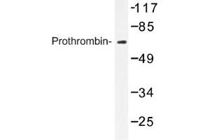 Image no. 1 for anti-Coagulation Factor II (thrombin) (F2) antibody (ABIN317606)