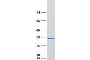 Validation with Western Blot