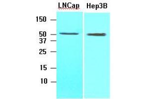Western Blotting (WB) image for anti-Acyl-CoA Thioesterase 11 (ACOT11) (AA 19-250) antibody (ABIN317516) (ACOT11 anticorps  (AA 19-250))