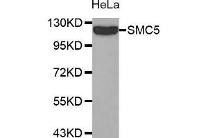 Western Blotting (WB) image for anti-Structural Maintenance of Chromosomes 5 (SMC5) antibody (ABIN1874872) (SMC5 anticorps)