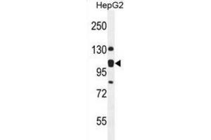 Western Blotting (WB) image for anti-KIAA0090 (KIAA0090) antibody (ABIN2995572) (KIAA0090 anticorps)