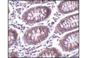 Immunohistochemistry of MICA in human colon tissue with this product at 10 μg/ml. (MICA anticorps  (C-Term))
