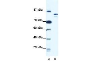 MCM8 antibody used at 0. (MCM8 anticorps  (N-Term))