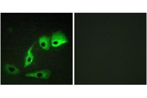 Immunofluorescence analysis of HepG2 cells, using Calmodulin (Ab-79/81) Antibody. (Calmodulin 1 anticorps  (AA 46-95))