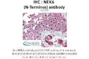 Image no. 2 for anti-NIMA (Never in Mitosis Gene A)-Related Kinase 6 (NEK6) (N-Term) antibody (ABIN1737252) (NEK6 anticorps  (N-Term))