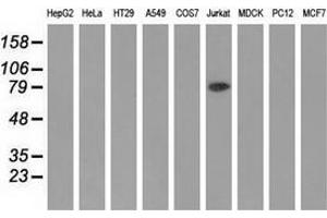 Western blot analysis of extracts (35 µg) from 9 different cell lines by using anti-ALDH1L1 monoclonal antibody. (ALDH1L1 anticorps)