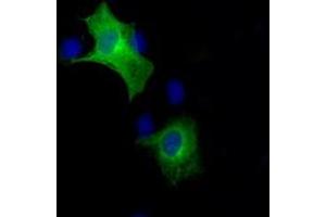Image no. 6 for anti-B-Raf proto-oncogene, serine/threonine kinase (BRAF) antibody (ABIN1496952) (BRAF anticorps)