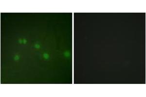 Immunofluorescence (IF) image for anti-Nuclear Receptor Subfamily 2, Group F, Member 2 (NR2F2) (AA 1-50) antibody (ABIN2889431) (NR2F2 anticorps  (AA 1-50))