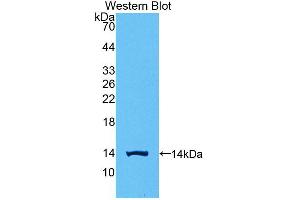 Western blot analysis of the recombinant protein. (CGB anticorps  (AA 55-153))