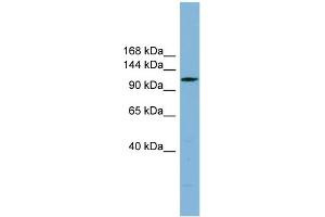 WB Suggested Anti-C14orf104 Antibody Titration: 0. (DNAAF2 anticorps  (N-Term))