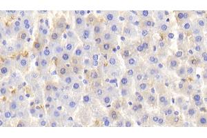 Detection of HB in Rat Liver Tissue using Polyclonal Antibody to Hemoglobin (HB) (Hemoglobin anticorps)