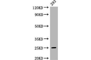 Western Blot Positive WB detected in: 293 whole cell lysate All lanes: Mad2L2 antibody at 1:2000 Secondary Goat polyclonal to rabbit IgG at 1/50000 dilution Predicted band size: 25 kDa Observed band size: 25 kDa (Recombinant MAD2L2 anticorps)