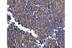 IHC analysis of KLF13 using anti-KLF13 antibody (ABIN7602036). (KLF13 anticorps  (AA 56-260))