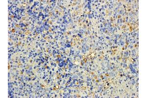 ABIN2563955 (5ug/ml) staining of paraffin embedded Rat Spleen. (MTMR9 anticorps  (C-Term))