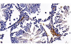 Detection of GYPA in Mouse Testis Tissue using Polyclonal Antibody to Glycophorin A (GYPA) (CD235a/GYPA anticorps  (AA 1-108))