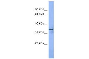 WB Suggested Anti-MAGEA2 Antibody Titration: 0. (MAGEA2 anticorps  (N-Term))