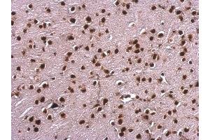 IHC-P Image Scaffold attachment factor B1 antibody detects Scaffold attachment factor B1 protein at nucleus on mouse fore brain by immunohistochemical analysis. (SAFB anticorps)
