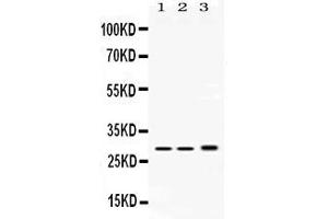 Western blot analysis of PSMA1 expression in rat testis extract ( Lane 1), mouse spleen extract ( Lane 2) and HEPG2 whole cell lysates ( Lane 3).