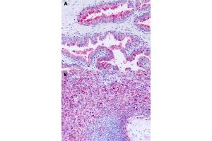 Immunohistochemical staining of formalin-fixed paraffin-embedded human prostate (A) and human spleen (B) with GPR63 polyclonal antibody . (GPR63 anticorps  (Cytoplasmic Domain))