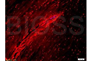 Formalin-fixed and paraffin-embedded rabbit meniscus tissue labeled with Anti-Collagen I Polyclonal Antibody, Unconjugated (ABIN670386) 1:300 followed by conjugation to the secondary PE antibody and DAB staining