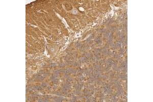Immunohistochemical staining of human cerebellum with RALGAPA1 polyclonal antibody  shows cytoplasmic positivity in Purkinje cells, cells in molecular layer and granular layer.