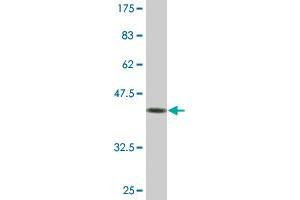 Western Blot detection against Immunogen (44.