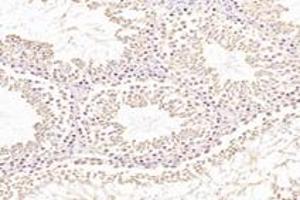 Immunohistochemistry analysis of paraffin-embedded rat testis using,NXF2 (ABIN7074901) at dilution of 1: 3000 (NXF2 anticorps)
