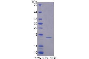 Image no. 1 for Profilin 4 (PFN4) (AA 1-125) protein (His tag) (ABIN6239661)