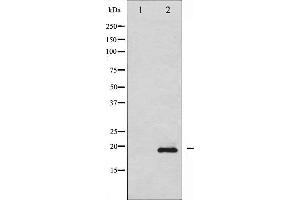 Western blot analysis of Stathmin 1 phosphorylation expression in 293 whole cell lysates,The lane on the left is treated with the antigen-specific peptide.
