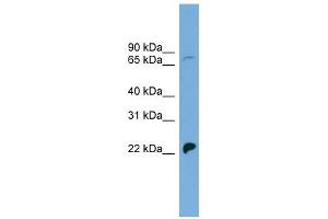 SLC5A5 antibody used at 1 ug/ml to detect target protein. (SLC5A5 anticorps)
