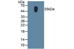 Figure. (ALT anticorps  (AA 367-480))