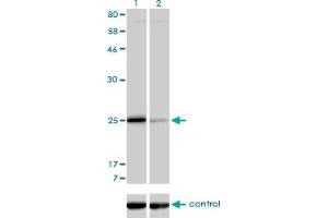 Western blot analysis of TNNI3 over-expressed 293 cell line, cotransfected with TNNI3 Validated Chimera RNAi (Lane 2) or non-transfected control (Lane 1). (TNNI3 anticorps  (AA 102-210))