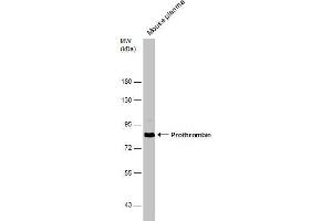 WB Image Mouse tissue extract (50 μg) was separated by 7.