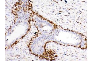 IHC analysis of Bcl-XL using anti-Bcl-XL antibody .