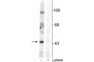 Western blot of rat testes lysate showing specific immunolabeling of the ~46 kDa EphrinB phosphorylated at Tyr331 in the first lane (-). (EPH Receptor B2 anticorps  (pTyr331))