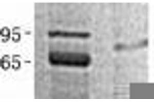 Validation with Western Blot