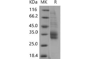 Western Blotting (WB) image for SLAM Family Member 8 (SLAMF8) (Active) protein (His tag) (ABIN7320214)