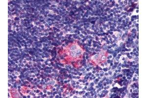 Immunohistochemical staining of Thymus using anti- P2RY5 antibody ABIN122464 (LPAR6 anticorps)