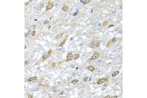 Immunohistochemistry of paraffin-embedded rat brain using HSPA6 antibody.