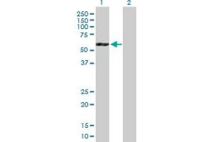 Western Blot analysis of ATP6V1B2 expression in transfected 293T cell line by ATP6V1B2 MaxPab polyclonal antibody.