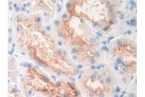 Detection of PMSA in Human Kidney Tissue using Polyclonal Antibody to Prostate-specific Membrane Antigen (PMSA)