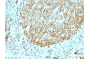 Formalin-fixed, paraffin-embedded human Tonsil stained with MALT1 Recombinant Mouse Monoclonal Antibody (rMT1/410). (Recombinant MALT1 anticorps  (AA 701-808))