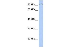 TRPC4AP antibody used at 1 ug/ml to detect target protein. (TRPC4AP anticorps  (Middle Region))