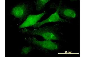 Immunofluorescence of monoclonal antibody to IBRDC2 on HeLa cell.