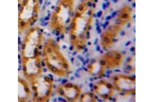Used in DAB staining on fromalin fixed paraffin-embedded Kidney tissue (Latexin anticorps  (AA 1-222))