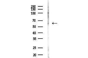 anti-Lectin, Galactoside-Binding, Soluble, 3 Binding Protein (LGALS3BP) (C-Term) antibody