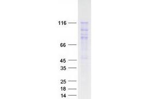 Validation with Western Blot