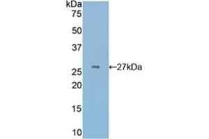 Detection of Recombinant CYR61, Mouse using Polyclonal Antibody to Cysteine Rich Protein, Angiogenic Inducer 61 (CYR61) (CYR61 anticorps  (AA 176-379))